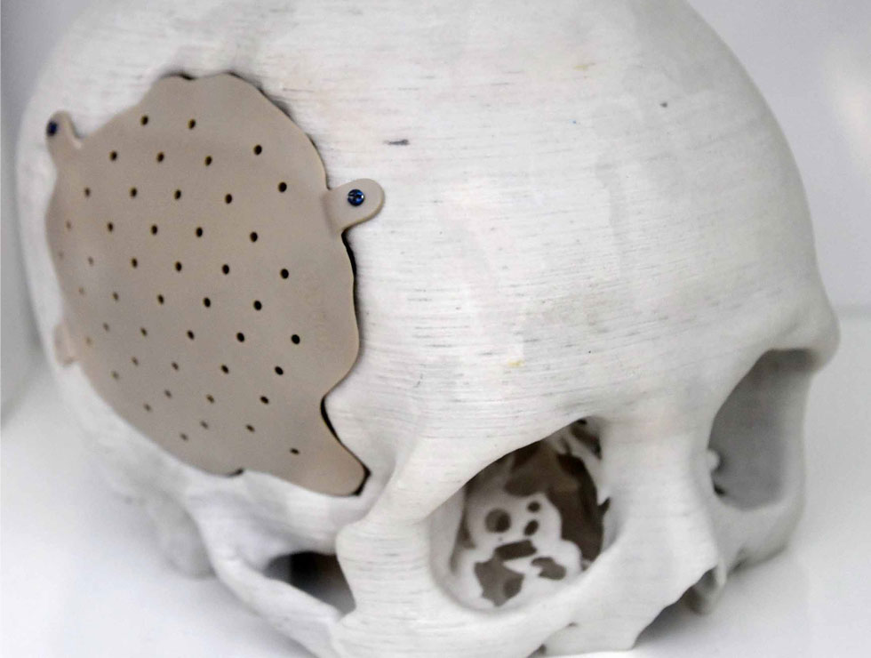 �@������ɫ�ĸ�ˎ��������Ŀ��������3D��ӡ���XĤ��